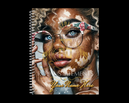 Vitiligo Visions Notebook Collection